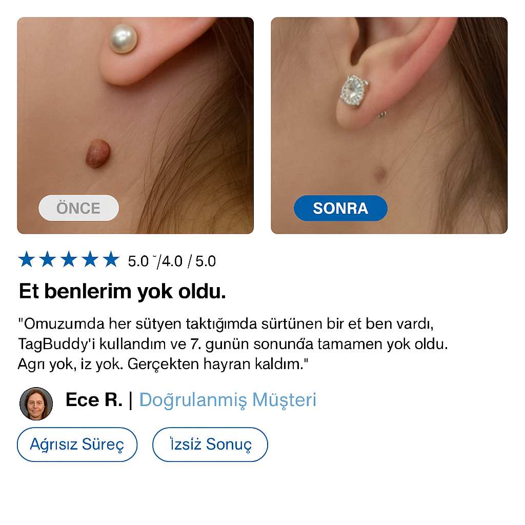 Maxubelle TagBuddy Kit™